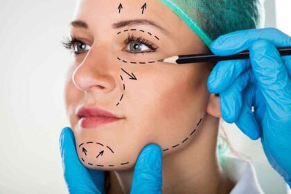 Facelift Surgery In Turkey